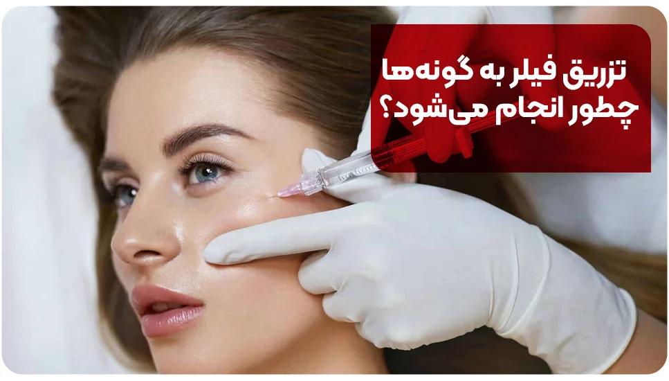 تزریق فیلر به گونهها چطور انجام میشود؟